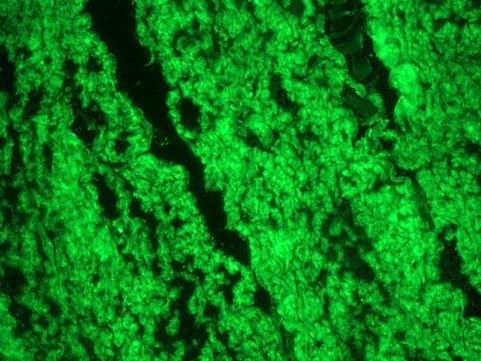 Figure 5. Smooth muscle cells in swine colon as detected by MUB1700P (R4A; dilution 1:100).